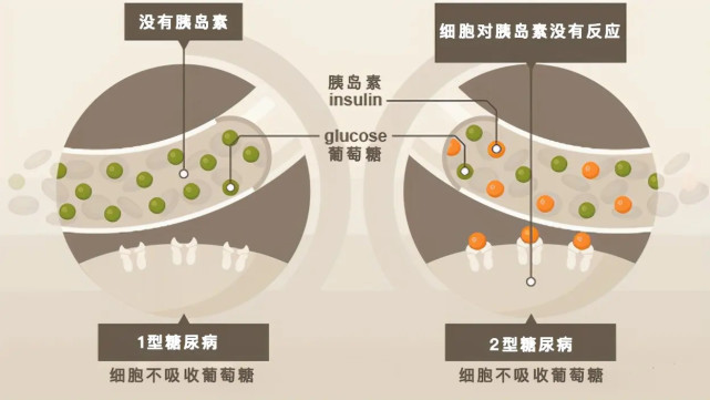 幹細胞治療糖尿病的主要機制