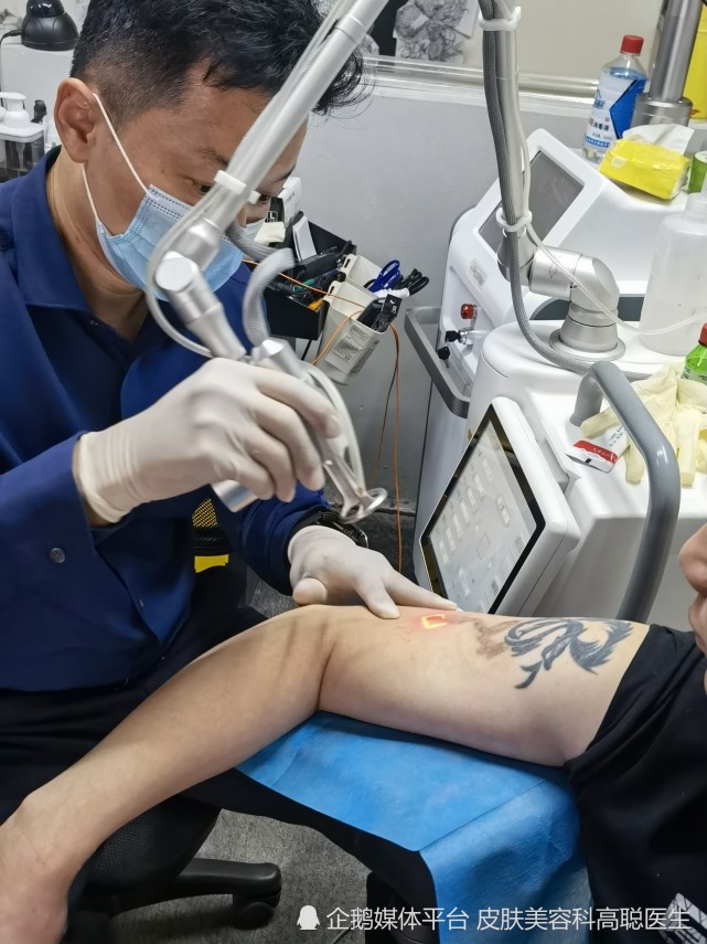 洗纹身不疼的方法有哪些?