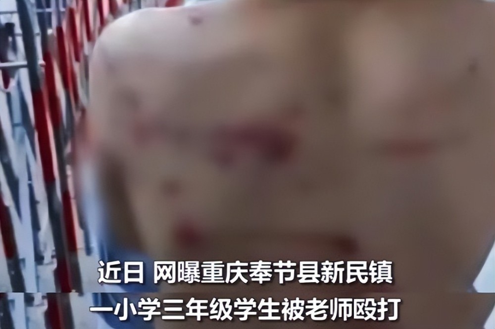 小学生遍体鳞伤只因做错两道题老师已被停职立案