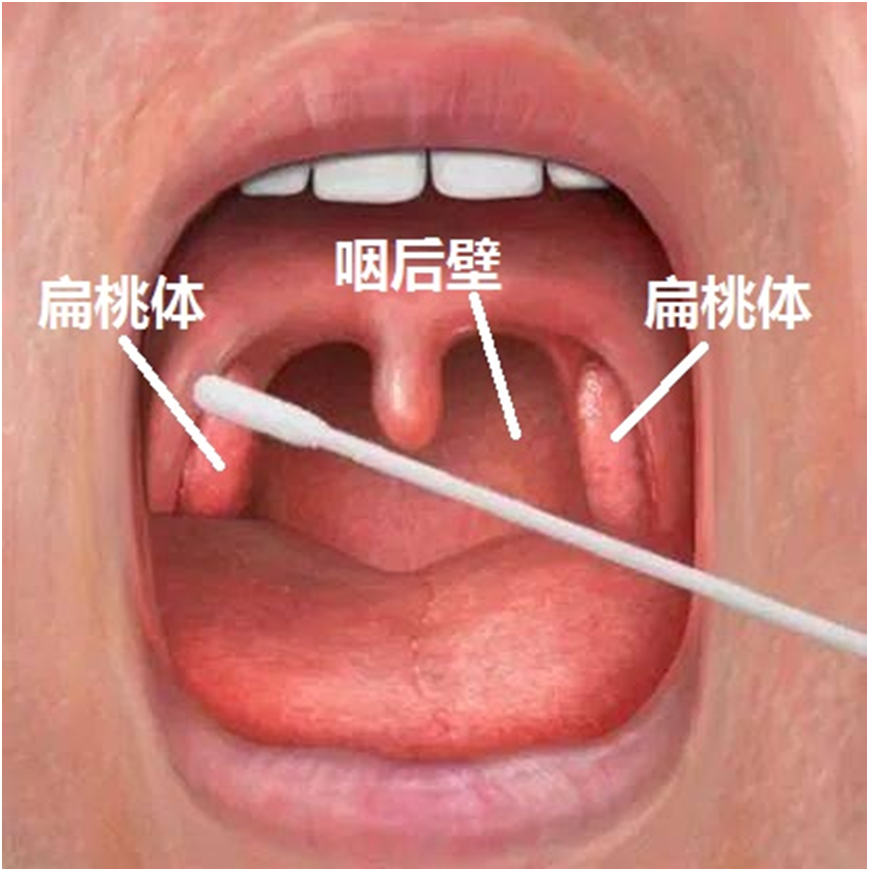 核酸鼻咽拭子采集部位图片