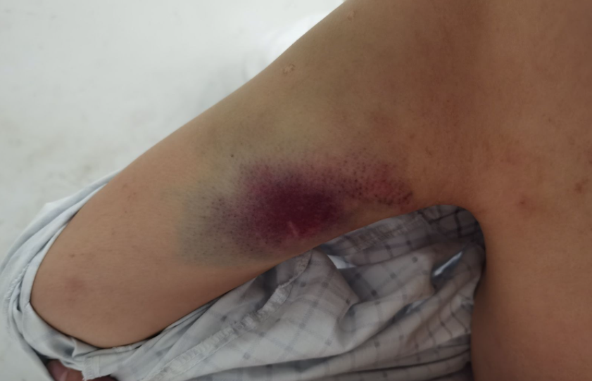 东北农村妇女被家暴吞噬50年的"自救"之路_腾讯新闻