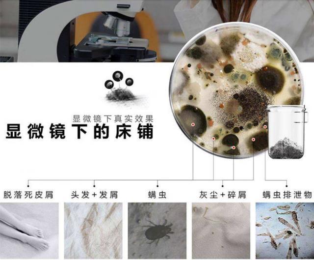 真实的螨虫是什么样子