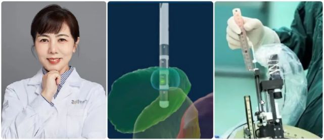 美敦力dbs特刊|专访301医院徐欣:可感知dbs技术 将为帕金森患者打开术