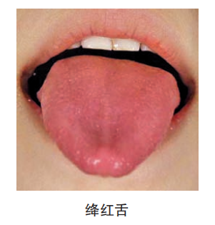 找一找有何不同—而当人体出问题时,舌象也会相应发生变化,出现绛红