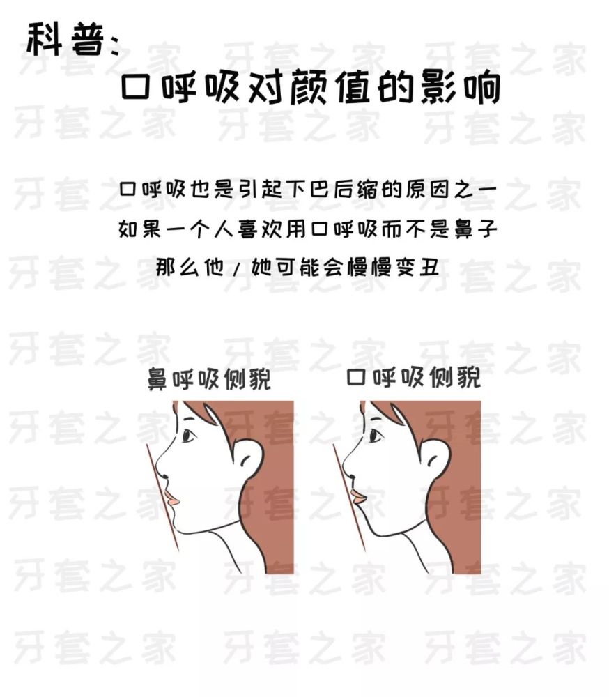 【安信科普】用嘴呼吸,越長越醜?_騰訊新聞