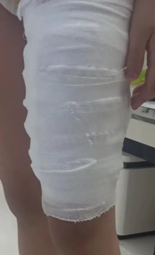 当"神经大条"的妈把孩子烫伤了……_腾讯新闻