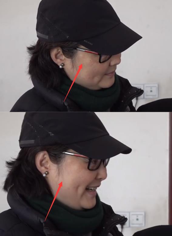 49岁袁立到县里医院探病,近照曝光肿一圈,脸上白斑突出引担忧