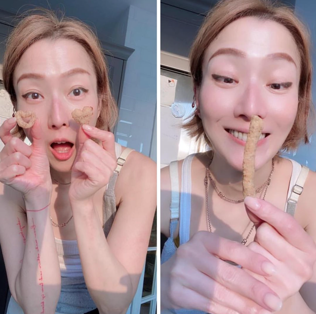 49岁郑秀文晒刮痧照片穿镂空上衣露出手臂纹身脖子肩膀红一片