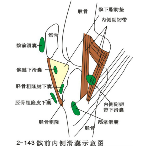 (3)内面baker's囊肿是最常见的腘窝囊肿,系膨胀的腓肠肌,半膜肌肌腱