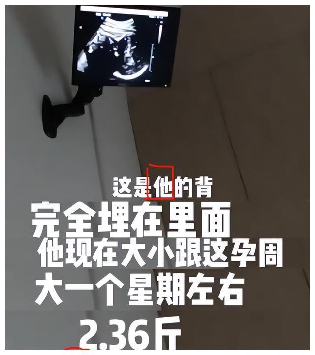 這是不是在暗示,肚子裡的小朋友是男寶寶.