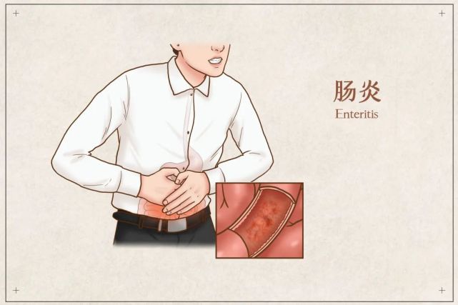 健康有道慢性肠炎知多少养护妙招解烦忧