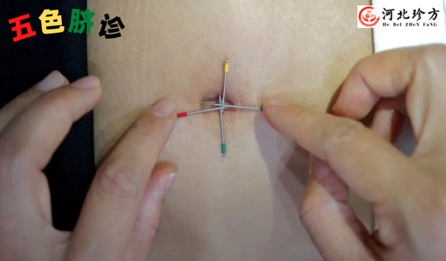【魏宦谨】"后天八卦"五色脐诊——288元九节线上直播课
