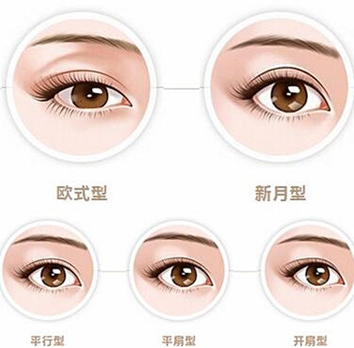 如何选择合适自己的双眼皮设计方案?
