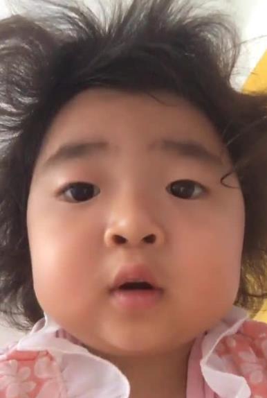 李欣蕊:4岁走红,不料早已身患肾病综合症,如今她的病怎么样了