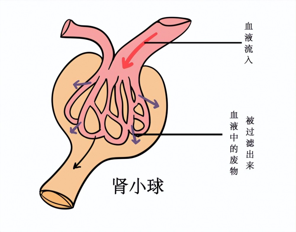 尿酸性腎病患者出現腎功能衰竭怎麼辦?高尿酸是如何損傷腎臟的?_騰訊