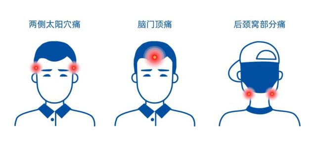 偏头痛就是一边脑壳痛?华西专家说,是脑壳偏偏就要痛