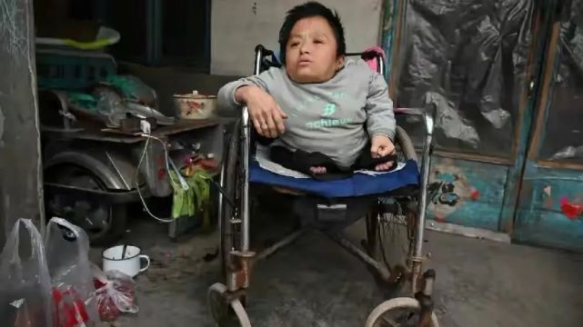 山东"瓷娃娃":身高60厘米,靠人喂饭40多年,最终迎来美满爱情