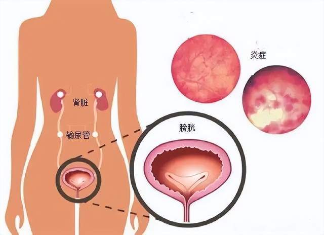 女性食物补肾_女人补肾的食物_食物女人补肾吃什么