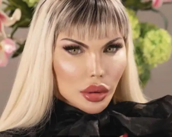 巴西男子因"整容入迷",砸百万从牙齿到腹肌都不放过,后来怎样?