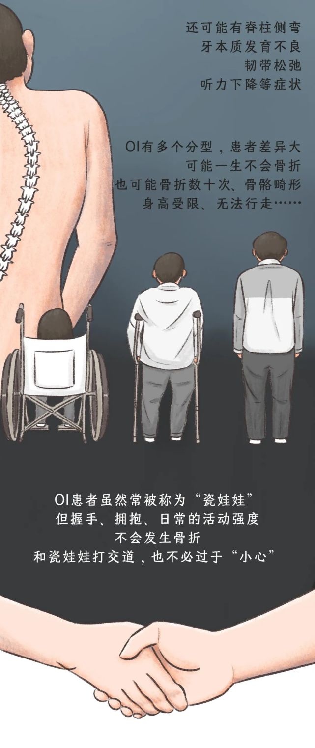与 wishbone day成骨不全症(osteogenesis imperfecta,oi)又名脆骨病