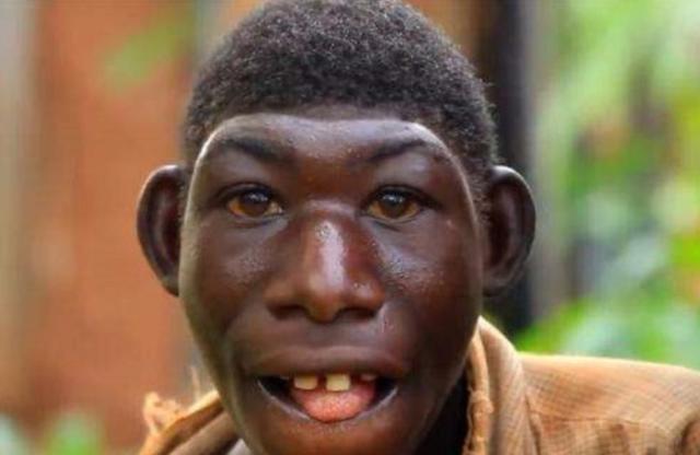 非洲男孩艾力长相返祖酷似猿猴以水果为食物一周跑230公里