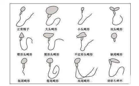 目前数据提示,畸形精子症会造成受孕机会降低,导致不育.