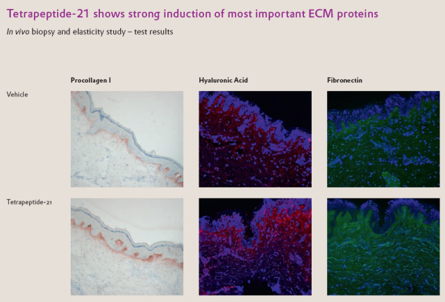 四肽-21,來源於皮膚的四胜肽,抗衰效果更勝基肽|細胞外基質|皮膚|抗衰