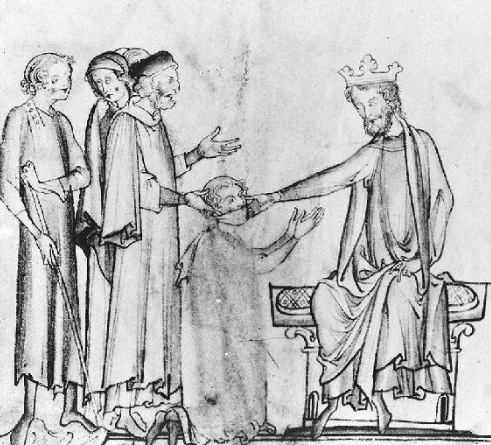 老鼠疮人们不惜挖开国王的坟墓只为用那骷髅手触碰肿胀的脖子