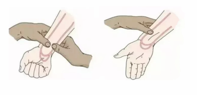 一针见血教你几招搞定桡动脉穿刺技术