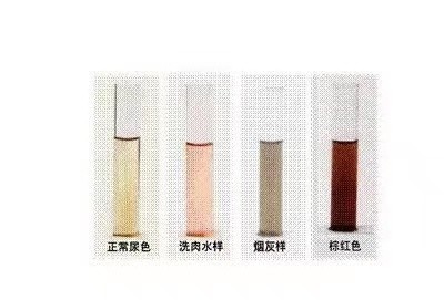 中代谢废物量减少,而此时肾小球滤过率下降,管壁破裂,管内的原尿外溢