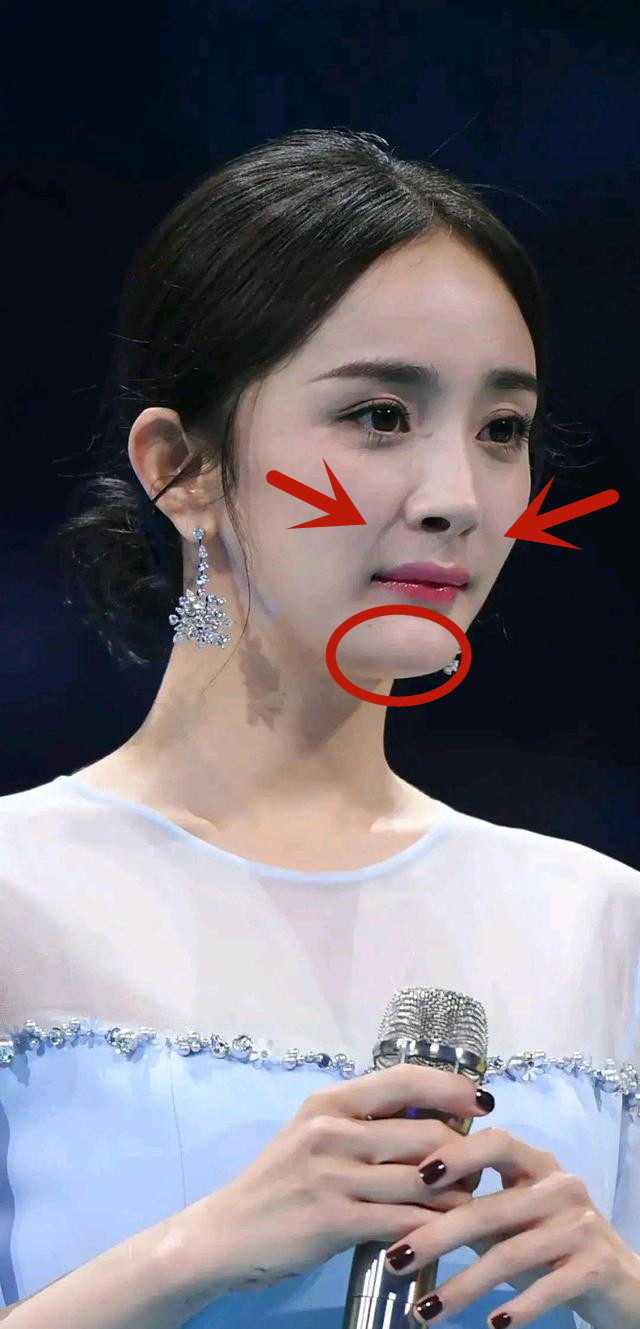 杨幂的下巴后缩也不是一天两天的事,早先参加活动时,她的扁平下巴就