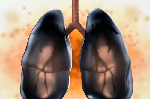 54岁大叔烟龄30年,肺却依然红润,医生:吸烟后这2件事