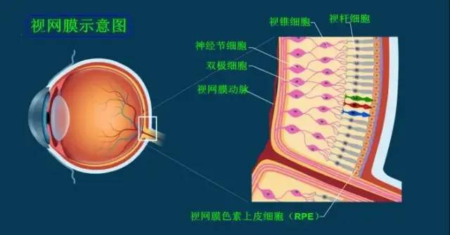 小心视网膜脱落!