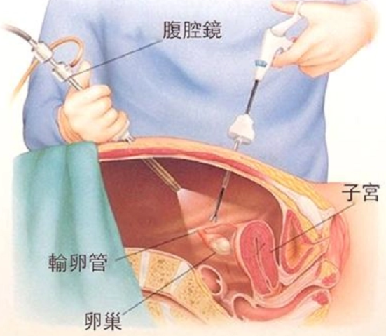 童梦世界!北京做输卵管疏通哪个医院好"纷至沓来"-第2张图片-华泰博客