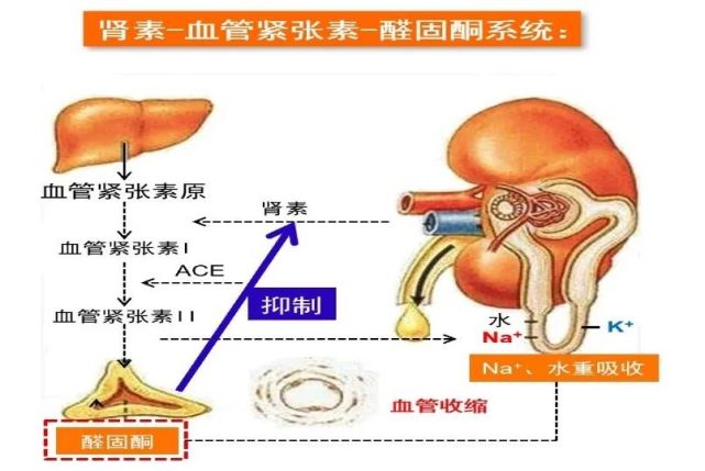 綜合徵具有關鍵的指示作用,尤其是原發性醛固酮增多症(也被稱為原醛)