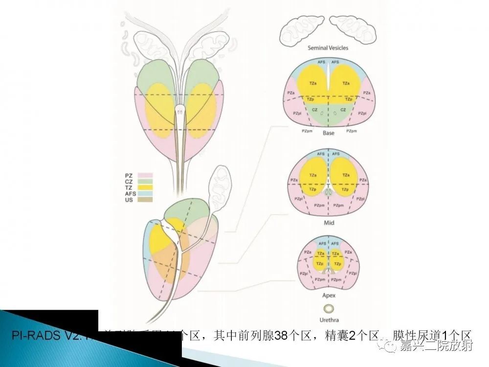 前列腺解剖分區及pi-rads v2.1版解讀_騰訊新聞