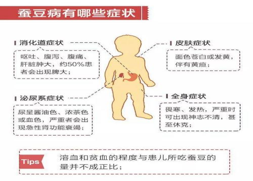 1对1!蚕豆病的治疗"沟通解决"-第1张图片-萨瓦博客