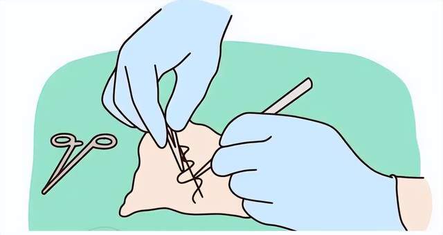 顺产时侧切和撕裂哪个对产妇影响更大早知道就好了