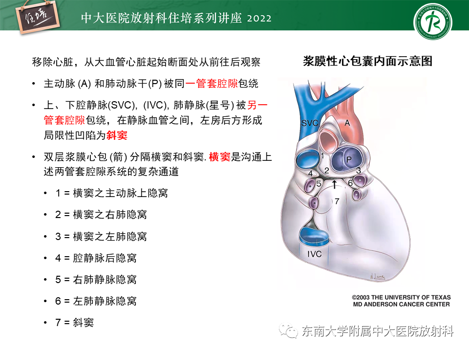 心包隐窝的ct解剖