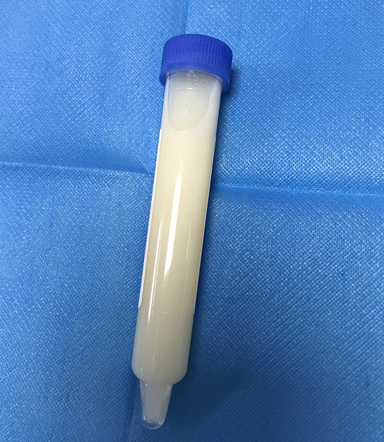 可怕湘西63岁大爷被蚊虫叮咬一口竟解出牛奶尿