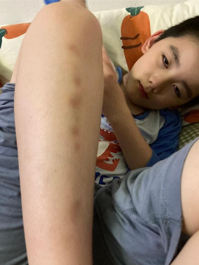 郭麒麟徒弟因学自行车,被摔得满腿淤青,却被父亲冯照洋发文调侃_腾讯