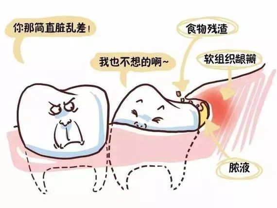 智齿|发炎|牙齿|面颊瘘