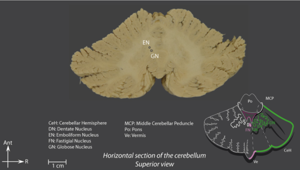 核和栓狀核合稱為中間核(interposed nucleus),在進化上屬於舊小腦