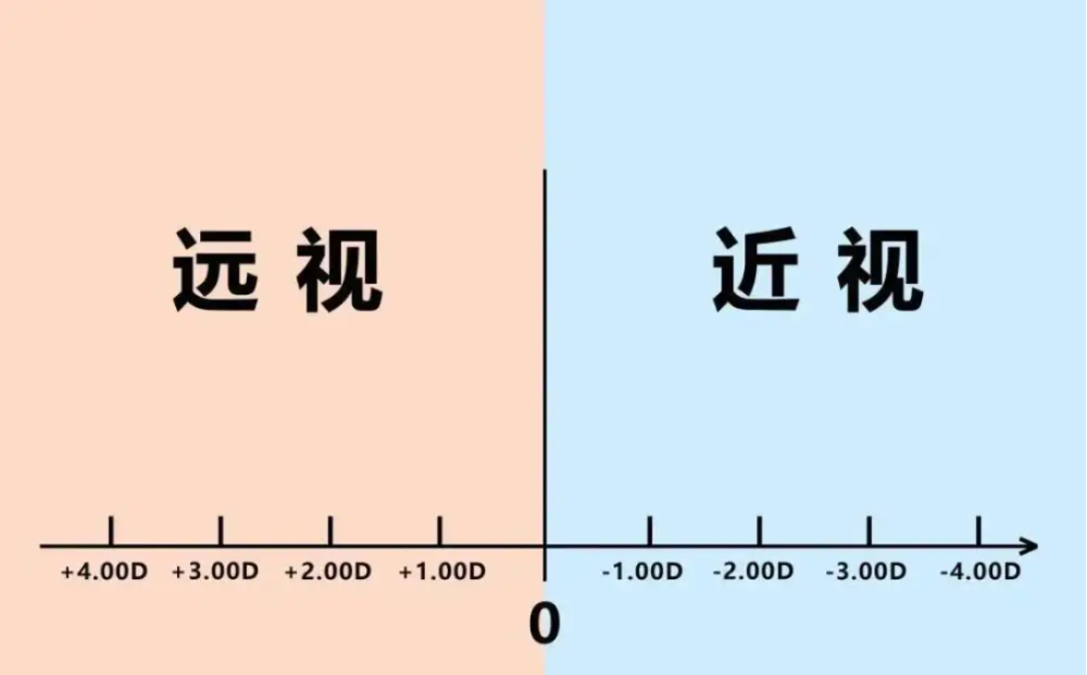 遠視眼和近視眼的區別