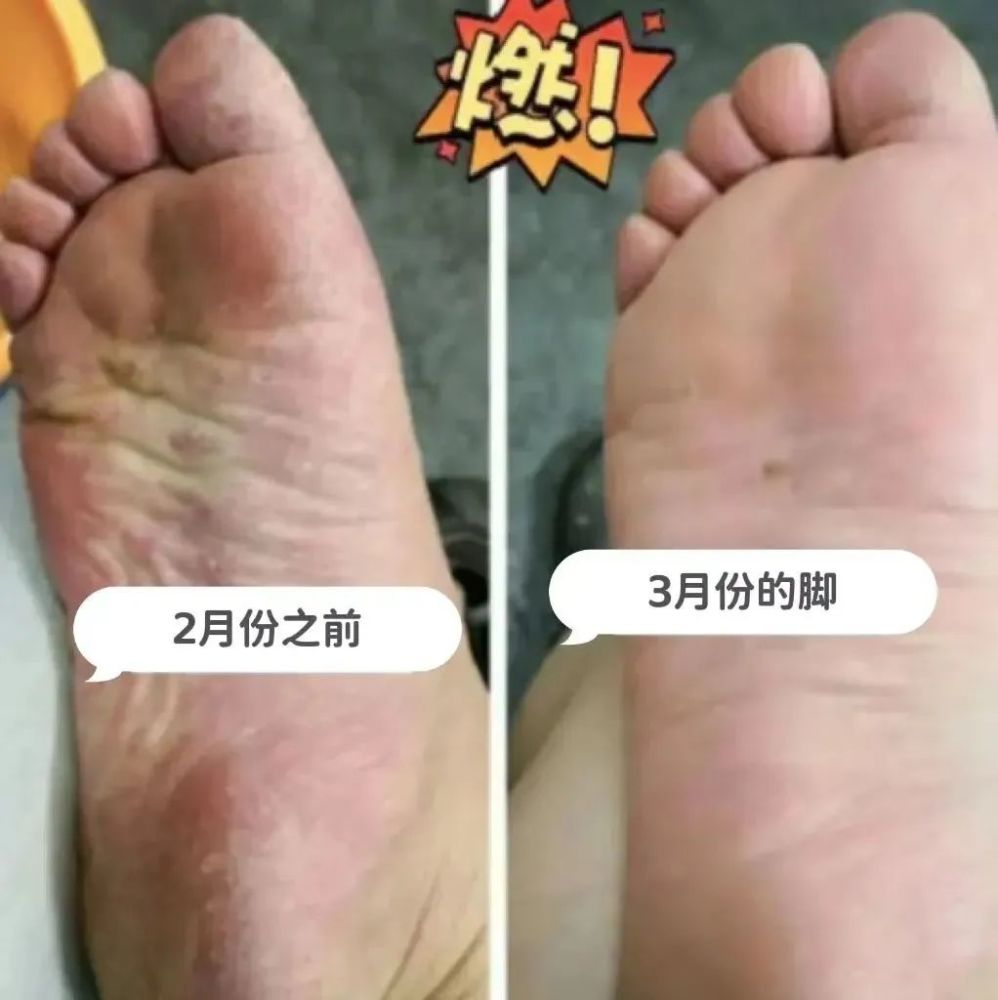 宇航員也有腳氣這款nasa聯名的腳氣噴霧一噴就好專業拯救腳臭腳癢