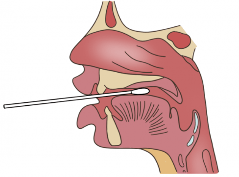 核酸时捅的到底是哪里?采样时这样做"大白"更喜欢你