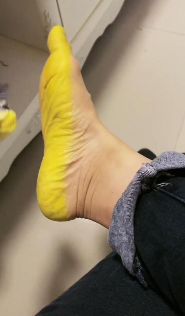 洛阳:女子夜市买到劣质袜子,穿一天后整个脚底板都被染黄