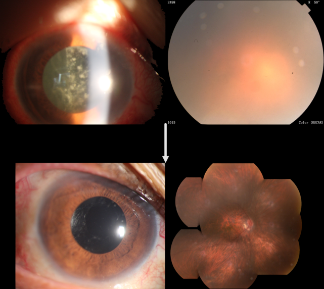 我想让眼睛只是眼睛,不再长石头,虫子,蘑菇和牙齿