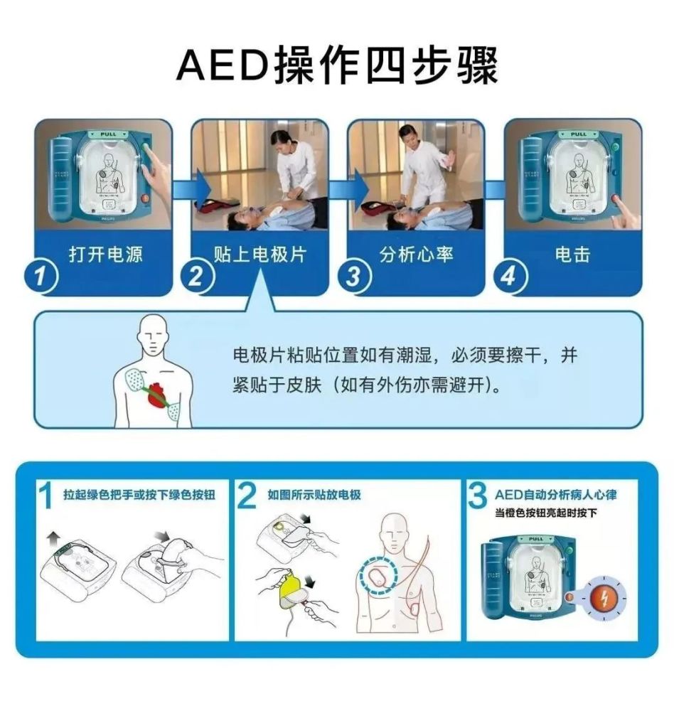 2贴电极片在患者胸部适当的位置上,紧密地贴上电极