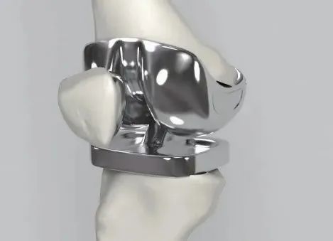 人工关节人工关节,一种由高达400万超高分子量的高密度聚乙烯,精密